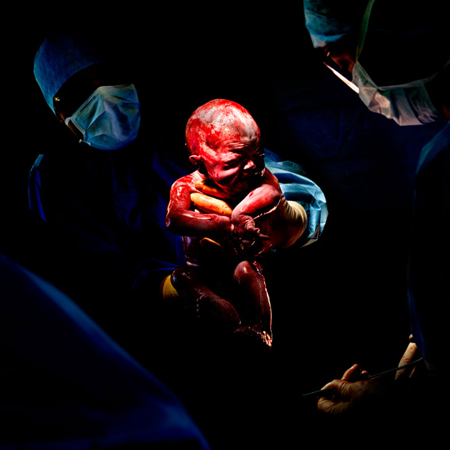 © Christian Berthelot - Margaux, 7 secondes après sa naissance