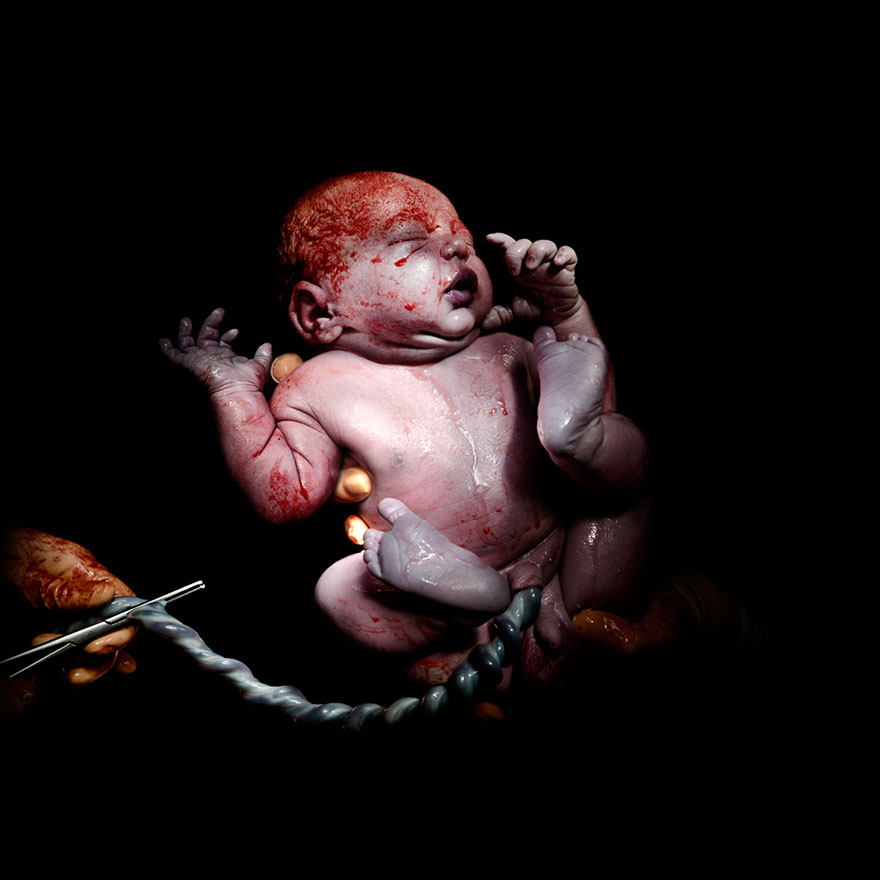 © Christian Berthelot - Kevin, 13 secondes après sa naissance