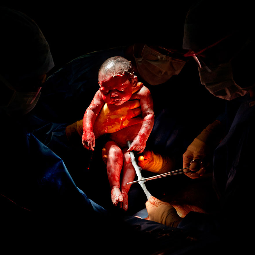 © Christian Berthelot - Liza, 3 secondes après sa naissance