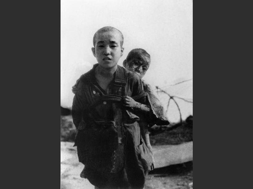 Deux enfants ayant survécu  le bombardement atomique d'Hiroshima - © AFP