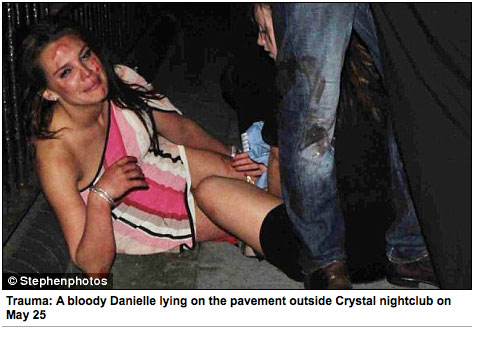 Danielle Lloyd, après son agression le 25 mai 2009. 