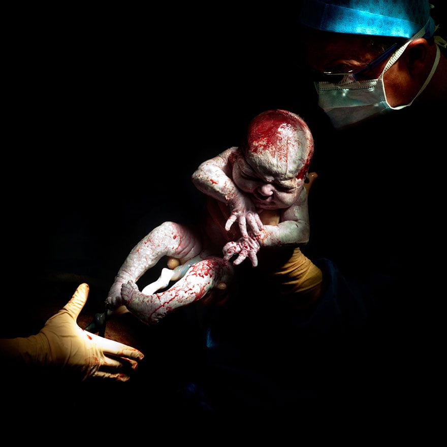 © Christian Berthelot - Louann, 14 secondes après sa naissance